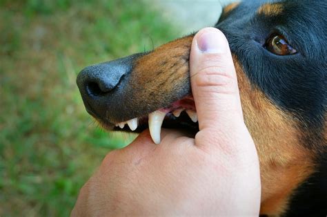  Exploring the Possible Significance of Canine Bites in Dream Imagery 