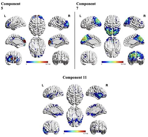  Exploring the Psychological Impact of Observing Intimate Partner Aggression in Dreams 