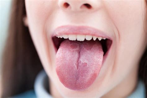  Exploring the Psychological Interpretations of Envisioning a Peeling Tongue 