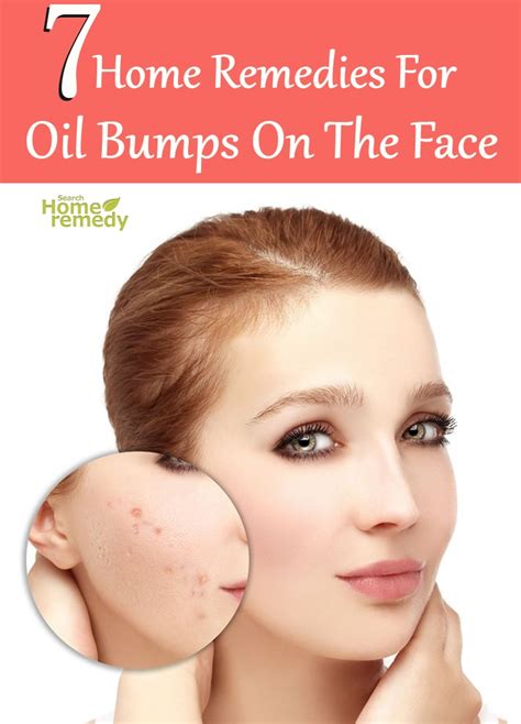  Home Remedies for Skin Bumps: Natural Solutions and Treatments to Try