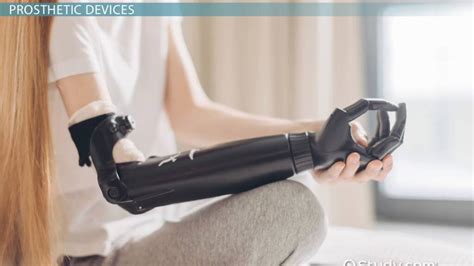 Addressing the Affordability Barrier: Ensuring Accessible Prosthetics for All