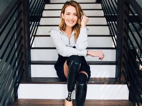 Amy Purdy Biography