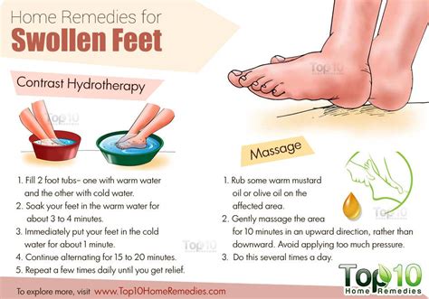 At-Home Remedies for Swollen Toes: