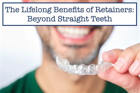 Benefits of Retainers: Beyond Oral Well-being