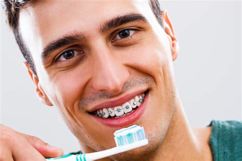 Brace Care Tips: Maintaining Oral Hygiene and Comfort