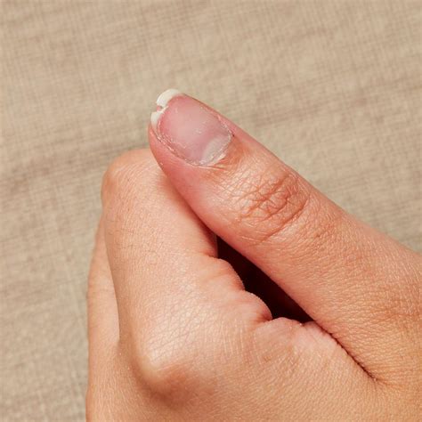 Broken Nail as a Representation of Vulnerability