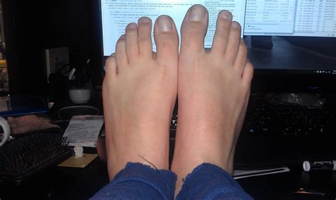 Challenges and Solutions for Individuals with Larger Feet