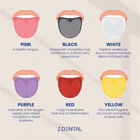 Changes in Tongue Color: Indicators of Potential Issues