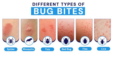 Common Emotions and Reactions Associated with Dreams of Insect Bites