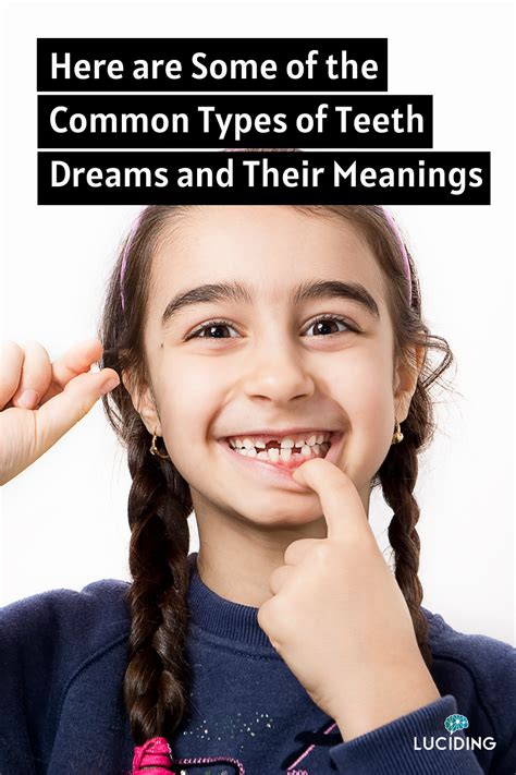 Common Explanations for Dreams Involving Damaged Teeth