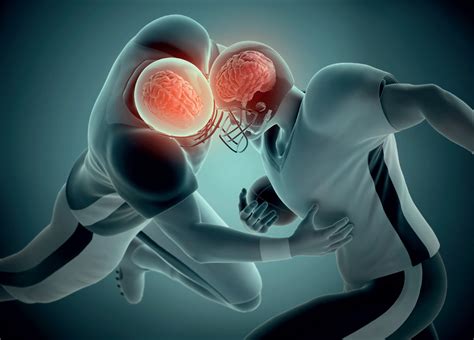 Concussions and Brain Injuries in Football: Investigating the Role of Headgear