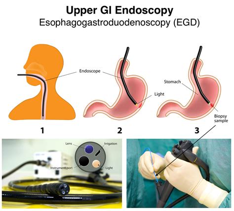 Cultural and Symbolic Associations Linked to Gastrointestinal Procedures