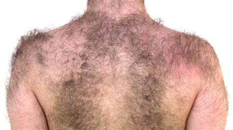 Debunking Misconceptions Surrounding Men with Excess Body Hair