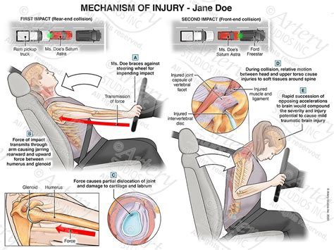 Deciphering the Psychological Impact of Enduring a Vehicular Collision in One's Dreams