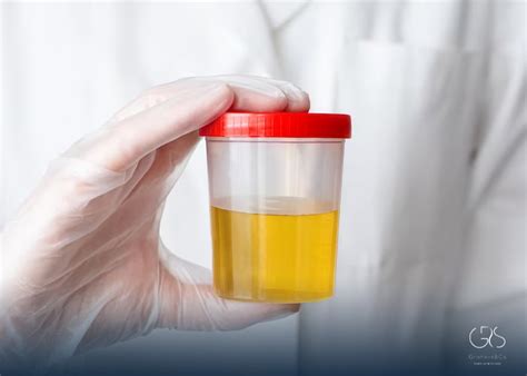 Decoding Yellow Urine: Unveiling its Significance