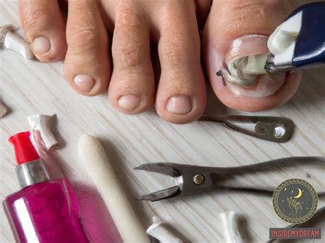 Decoding the Potential Emotional and Personal Significance Behind Dreams of a Missing Toenail