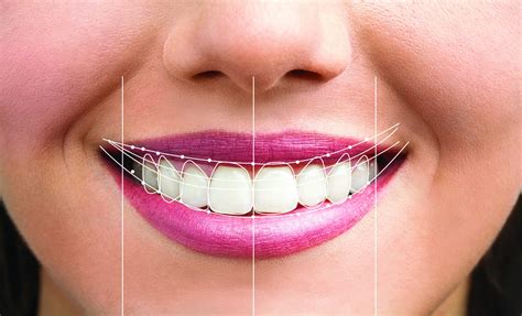 Discover the Ideal Dentist for Transforming Your Desired Grin