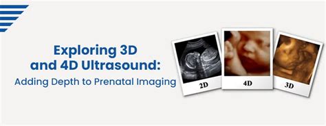 Diving Into the Enigma: Exploring Sonograms and Their Role in Prenatal Imaging