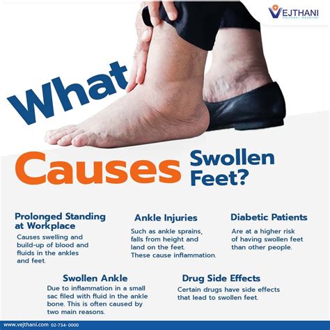 Dreaming of Swollen Feet: Exploring the Causes, Indicators, and Effective Care