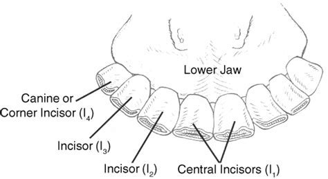 Exploring the Emotional and Physical Factors behind Dreams of Impaired Dental Structures