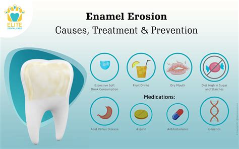 Exploring the Enigma: Unraveling the Hidden Significance of Darkened Dental Enamel