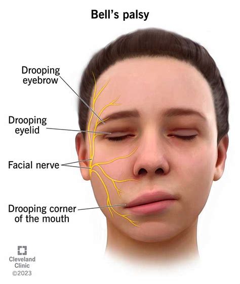 Exploring the Nature of Facial Swelling in Dreamscapes