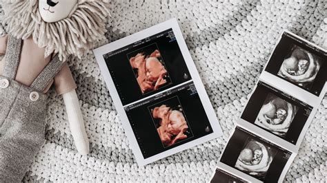 Exploring the Wonders of 3D/4D Ultrasounds: Capturing Precious Memories Before Birth