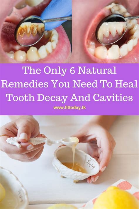 Home Remedies: Natural Ways to Soothe Your Oral Cavity