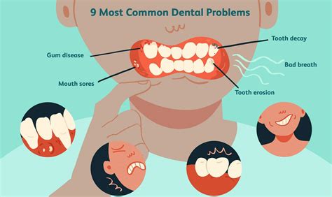 Identifying Potential Dental Issues Associated with Dreaming of a Deceased Tooth