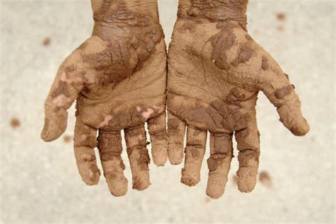 In what Way Can Dreaming about Dirty Hands Reflect Feelings of Uncleanliness?