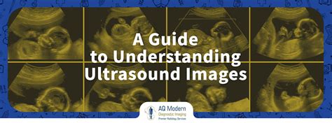 Interpreting Ultrasound Images: Understanding the Significance of Different Features