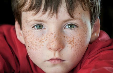 Life Behind the Freckles: Relationships and Family