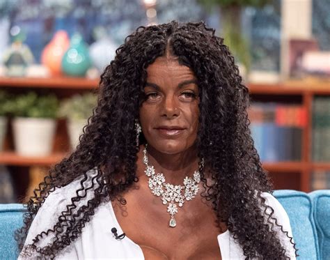 Martina Big's Controversial Skin Transformation