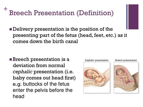 Medical Interventions for Breech Presentation