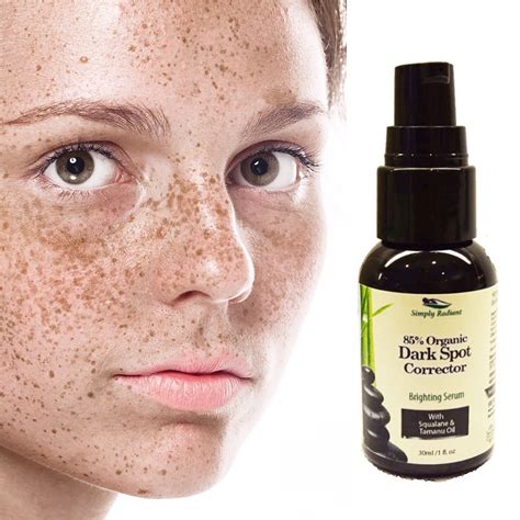 Medical Treatments for Dark Spots on Facial Skin