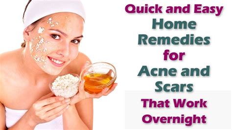 Natural Remedies for Acne Scars: Harnessing the Power of Herbal Medicine