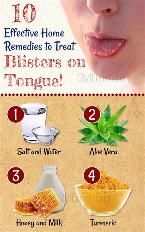 Overcoming the Discomfort: Effective Home Remedies for an Enlarged Tongue