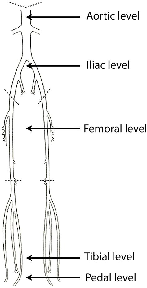 Practical Advice for Handling Symbolic Representations of Blood on the Lower Limbs
