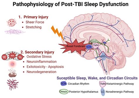 Psychological Factors That May Influence Dreaming about Public Transportation Mishaps