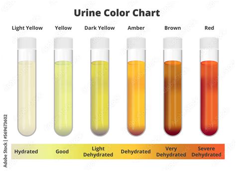 Recognizing Red Flags with Dark Urine: Knowing When to Seek Medical Help