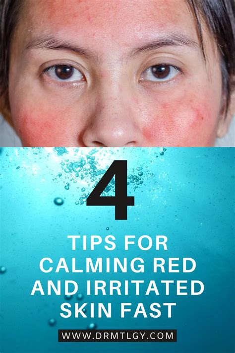 Relief for Irritated Skin: Soothing Strategies for Skin Discomfort