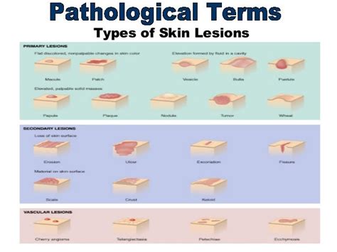 Seeking Medical Guidance: When to Consult a Healthcare Professional About Skin Lesions