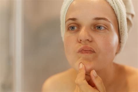 Skincare Secrets: Tips and Tricks for Treating and Preventing Skin Splitting