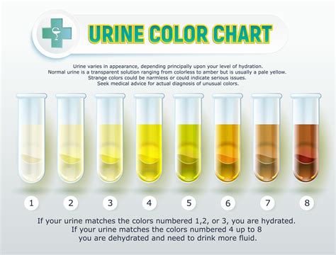 Symptoms Indicating Pale Urine: What to Watch out for