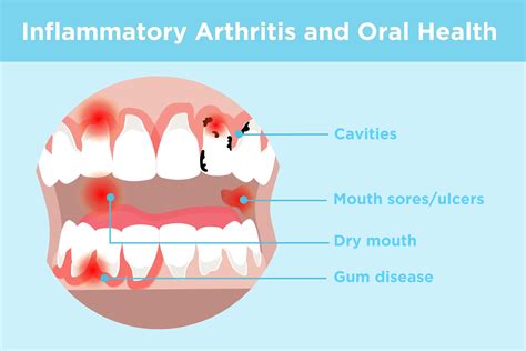 Symptoms of Oral Inflammation