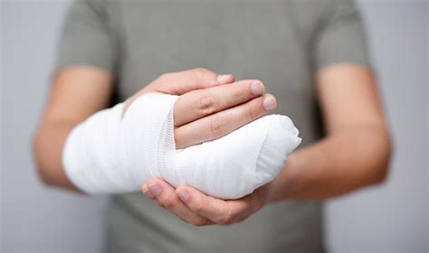 Taking Action: How to Respond to Dreams of Injured Hands and Their Significance