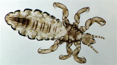 The Evolutionary History of Lice and Human Interaction