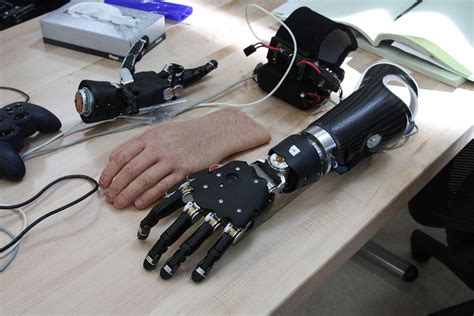 The Future of Advanced Prosthetic Limbs: Emerging Technologies and Innovations