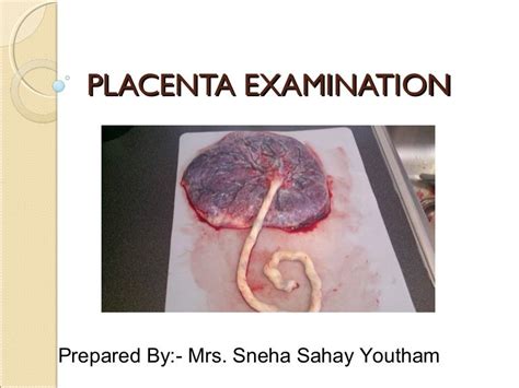 The Historical Uses of Placentas in Medicine