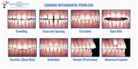 The Impact of Dental Injuries on Alignment of Anterior Teeth